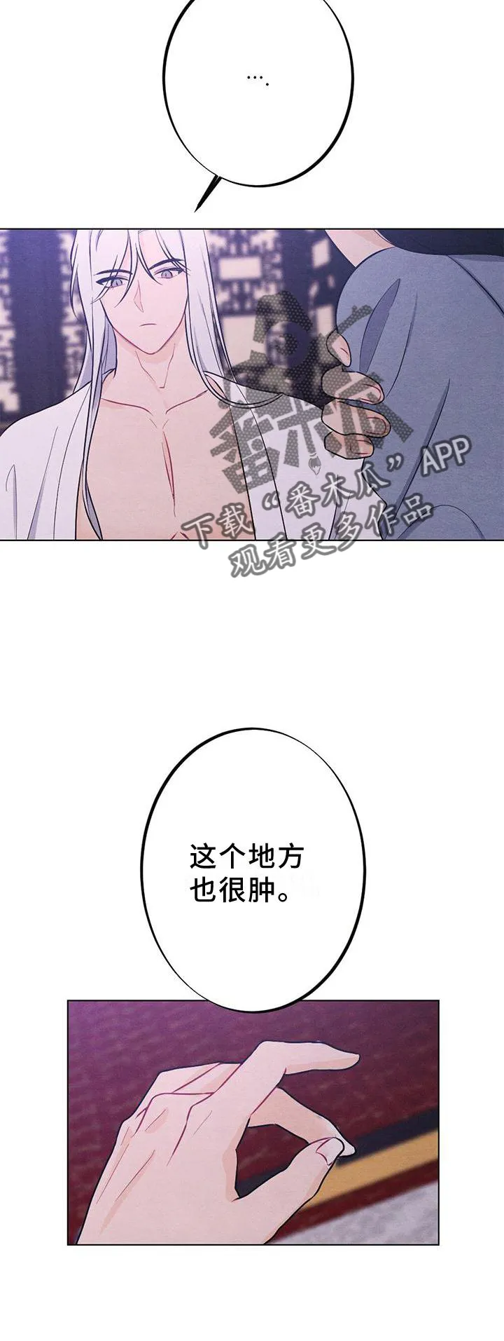 银狼的疼爱漫画漫画,第18章：擦药20图