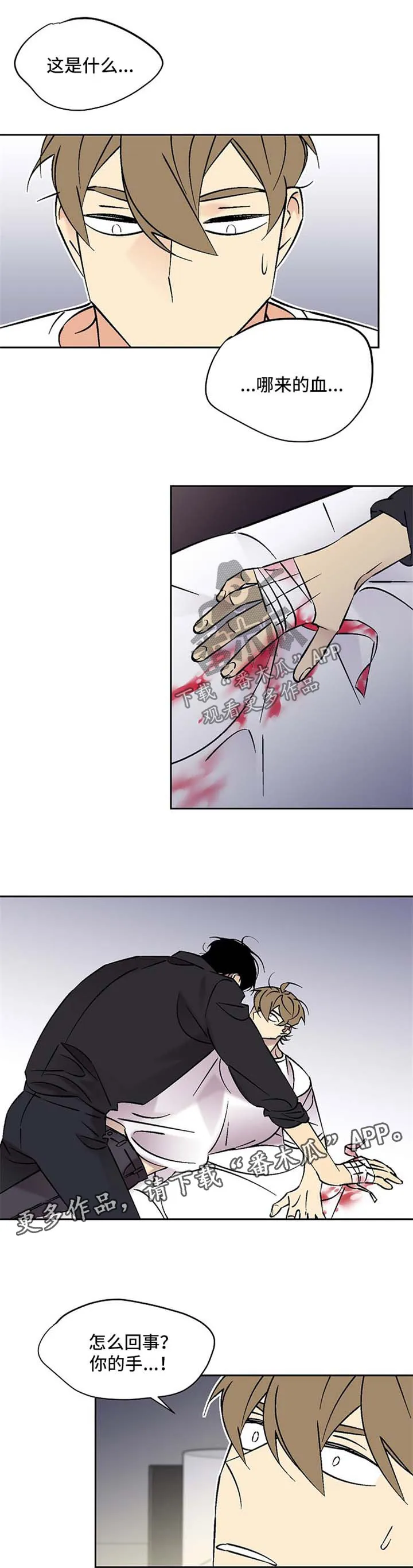 独家合同漫画漫画,第75章：受伤1图